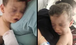 Kan donduran iddialar: 2 Yaşındaki bebek kabusu yaşadı!