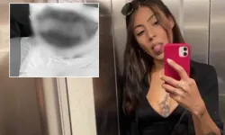 Kıskançlık krizi geçiren kadın tarafından yakıldı