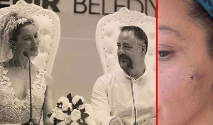 Ünlü oyuncu eşi tarafından darp edildi