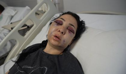 Oğlunun gözü önünde anneyi öldüresiye dövdüler