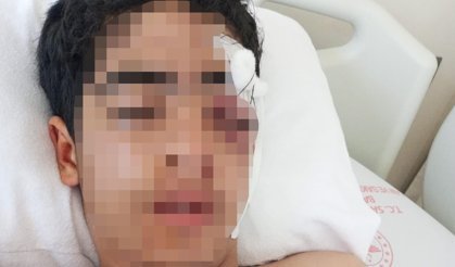 15 yaşındaki çocuk akranları tarafından muştayla dövüldü