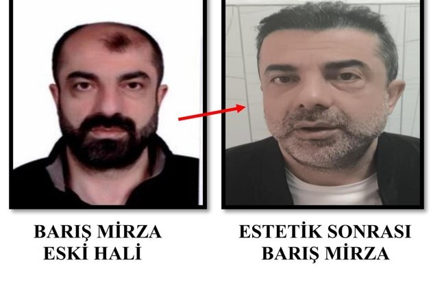 Yüzünü değiştirip firari olan cinayet zanlısı yıllar sonra yakalandı