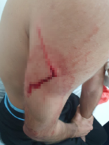 Wmremove Transformed (3)-2