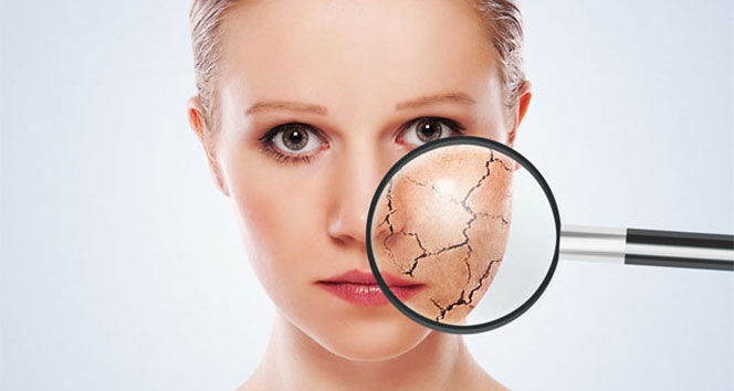 Kışın cilt kuruluğuna karşı 6 etkili yöntem!