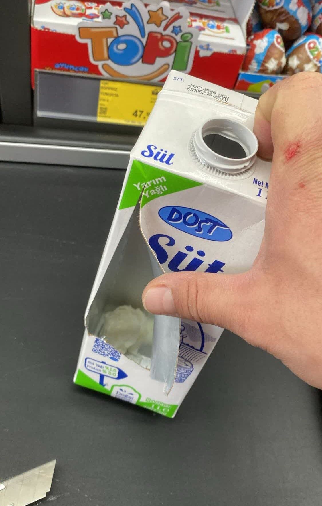 Dost Sutunde Kagit Havlu Parcasi Tespit Edildi Saglik Riski 2